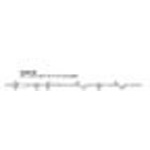 Product Image IV Solution Set, 10 Drop, w/Duo-Vent Spike, 2 Inj Site, Male Luer Lock Adapter, 104inch
