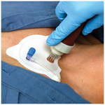 Product Image FAST1 Intraosseous Infusion System