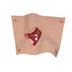 Product Image Simulaids Bleeding Moulages, Compund Fracture Humerus
