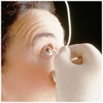 Product Image Morgan Lens Eye Therapeutic, Disposable, Inserted within 20 seconds of arrival.