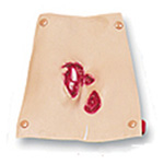 Product Image Simulaids Bleeding Moulages, Compund Fracture Tibia