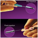 Product Image Protectiv Acuvance Safety IV Catheter, 24ga x 5/8inch