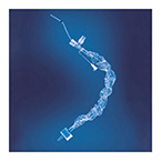 Product Image Catheter, Closed Suction, Trac Care Wet Pack, Directional Tip, Lavage/Irrigation Port, Adult 14 Fr