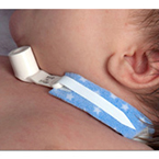 Product Image Tracheostomy Tube Holder, PediPrints®, Infant, Fits up to 9 Inch neck