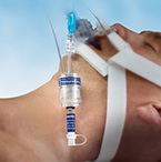 Product Image Endotracheal Tube Holder, SecureEasy, Adult, Integrated Soft Bite Block, Soft Foam