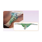 Product Image Tracheostomy Mask, Bariatric, Adult, Velcro Attachment Tabs